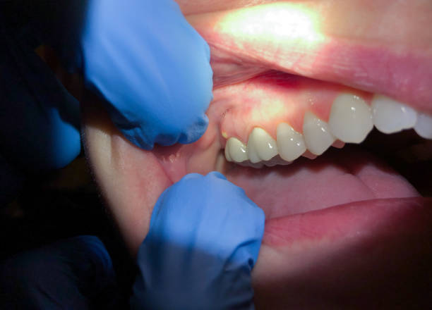 Best Pediatric Emergency Dentist in Glendale, MO