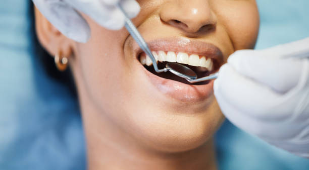 Best Emergency Root Canal Treatment in Glendale, MO